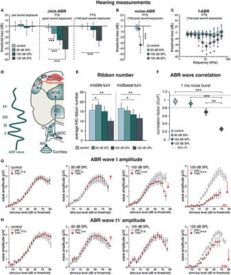 Visualizing BDNF Transcript Usage During Sound-Induced Memory Linked Plasticity